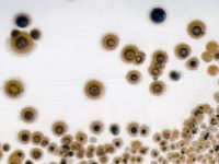 Bacterial & Fungal & Parasite-Based Human Pathogens Assays