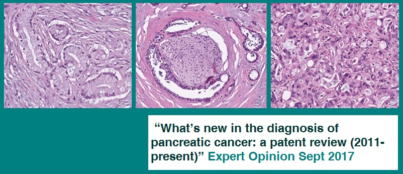 ▪ What’s new in the diagnosis of pancreatic cancer: a patent review (2011-present)